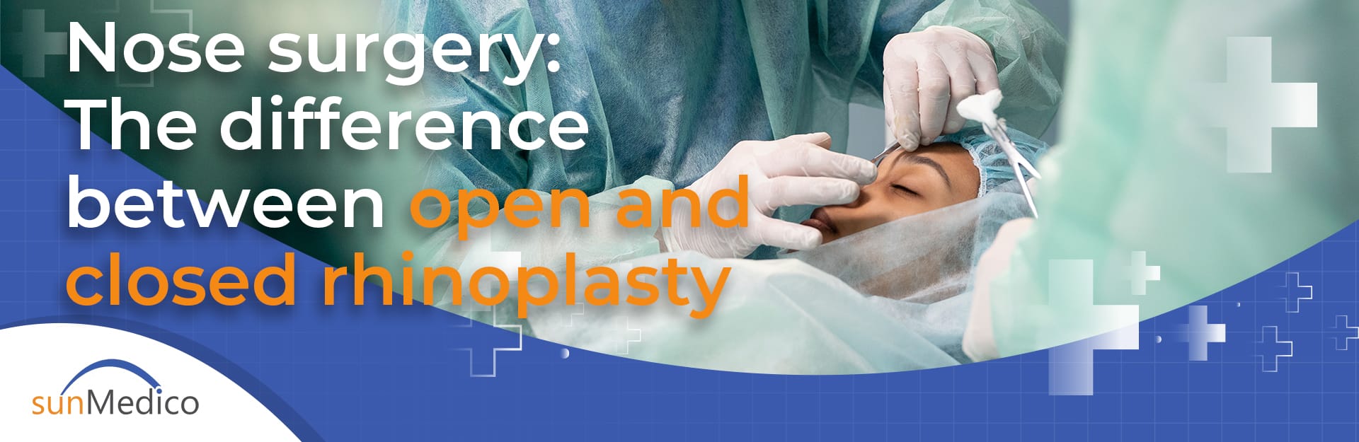 Nose surgery: The difference between open and closed rhinoplasty
