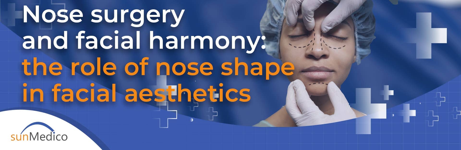 Nose surgery and facial harmony: the role of nose shape in facial aesthetics