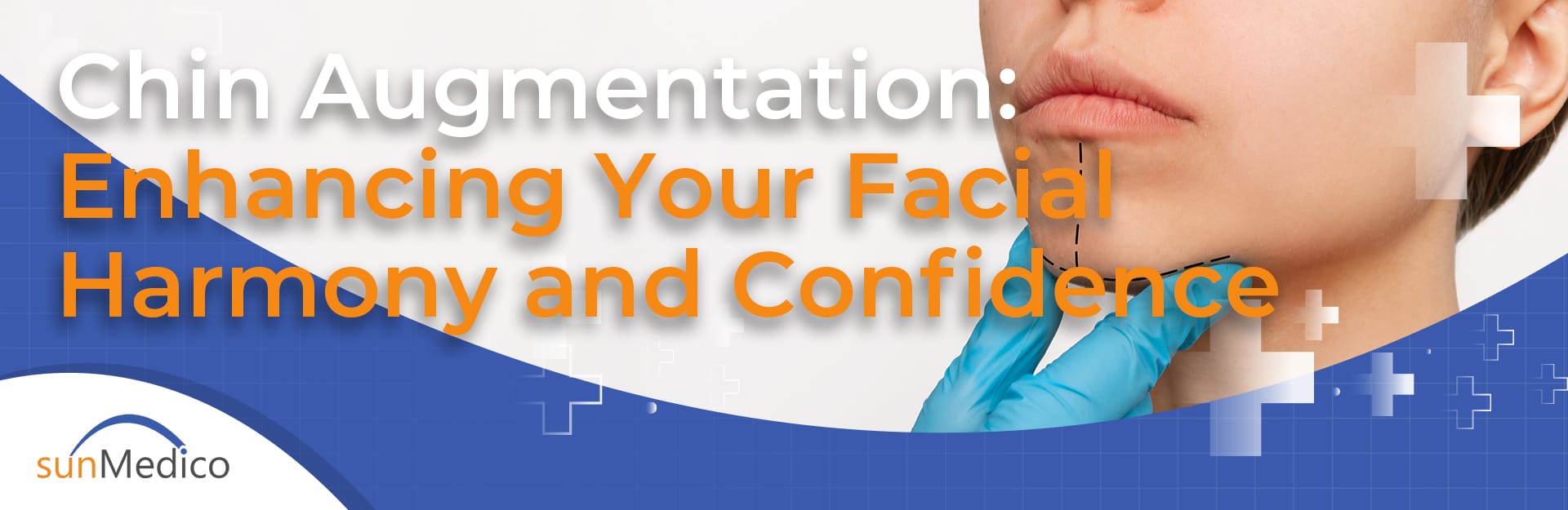 Chin Augmentation: Enhancing Your Facial Harmony and Confidence