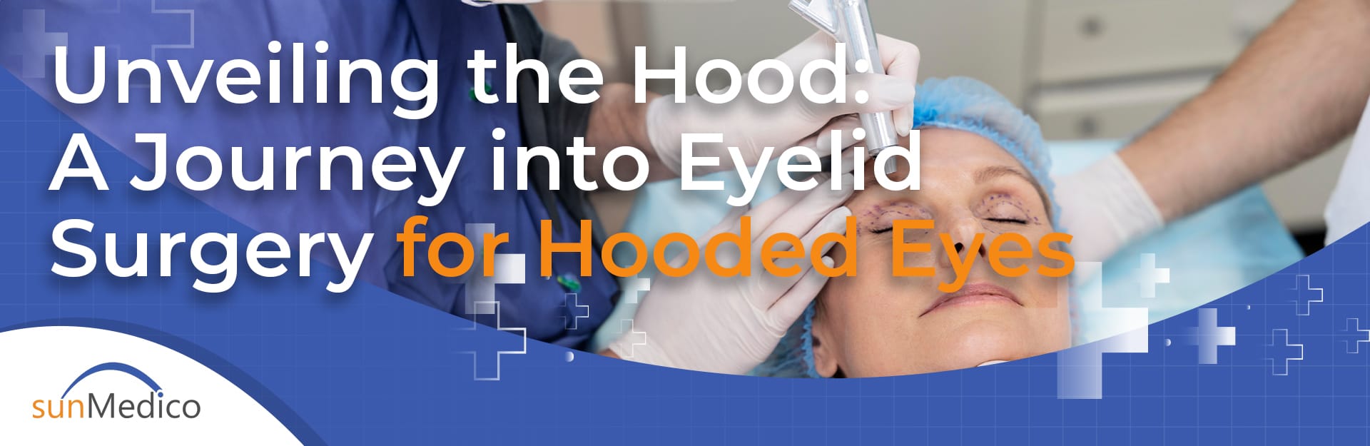 Unveiling the Hood: A Journey into Eyelid Surgery for Hooded Eyes