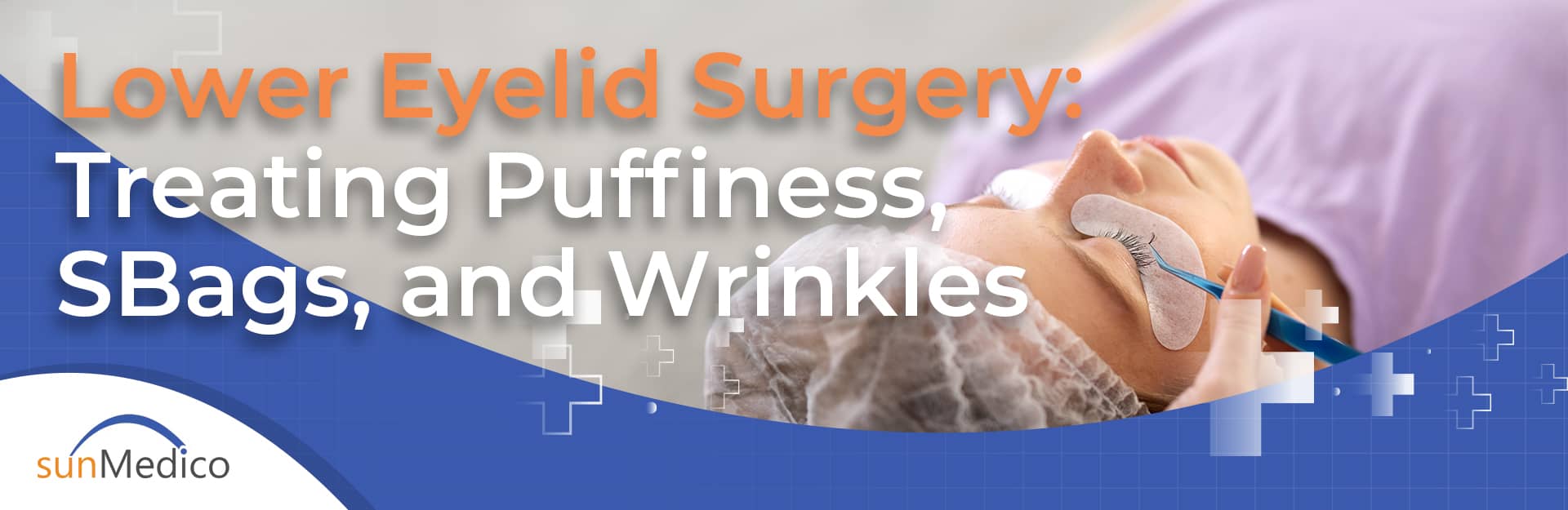 Lower Eyelid Surgery: Treating Puffiness, Bags, and Wrinkles