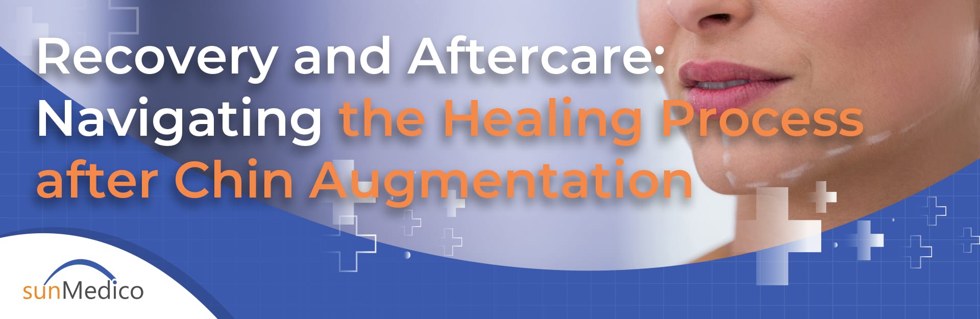 Recovery and Aftercare: Navigating the Healing Process after Chin Augmentation