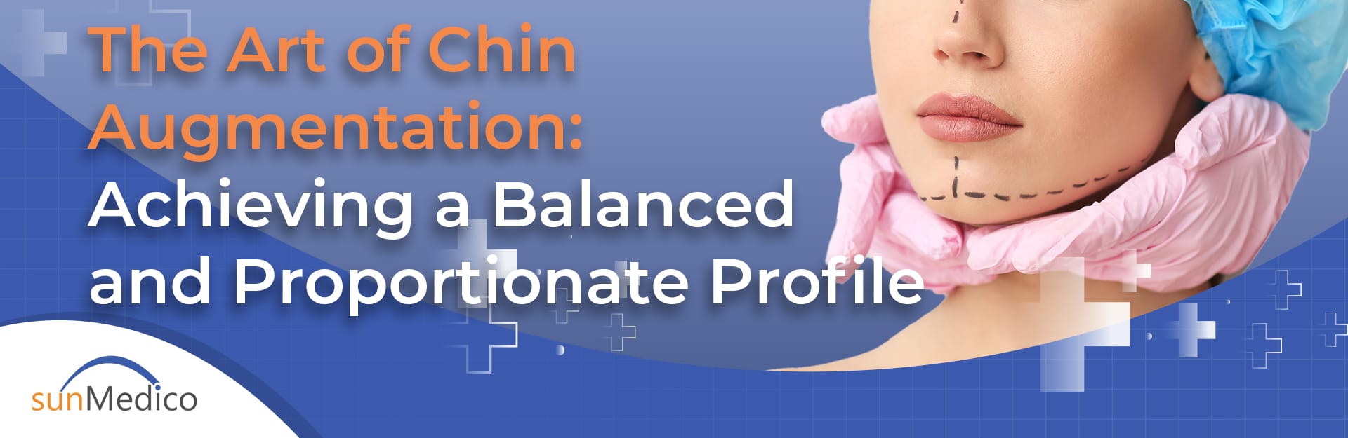 The Art of Chin Augmentation: Achieving a Balanced and Proportionate Profile