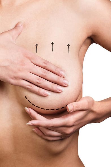 How to get a professional breast lift in Thailand cheap