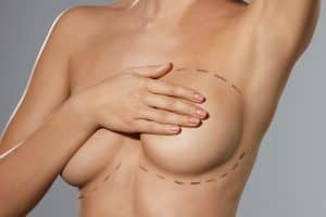 surgical treatments breasts
